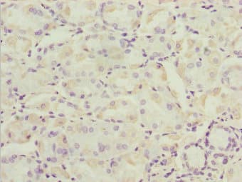 Polyclonal Rabbit anti-Human SNX7 Antibody (IHC)