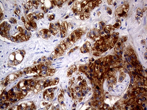 AMACR / P504S Antibody (clone OTI2E3)