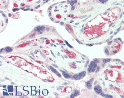 IHC-plus™ Polyclonal Rabbit anti-Human IBSP / Bone Sialoprotein Antibody (IHC)