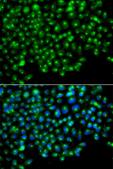 Polyclonal Rabbit anti-Human GOPC / PIST Antibody (IHC, IF, WB)