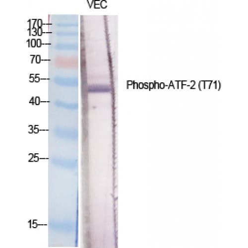 ATF2 Antibody (10-90 aa)