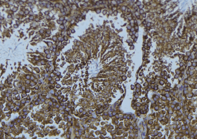 TPH1 / Tryptophan Hydroxylase Antibody
