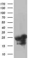 AK4 / Adenylate Kinase 4 Antibody (clone OTI3A9)
