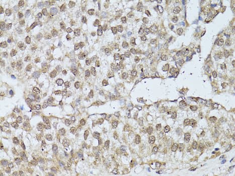 ER Alpha / Estrogen Receptor Antibody