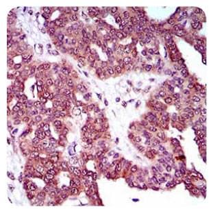 Monoclonal Mouse anti-Human DNM1L / DRP1 Antibody (clone 4E11B11, aa100-250, IHC, WB)