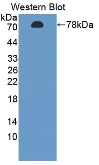 FDPS Antibody (aa1-419)