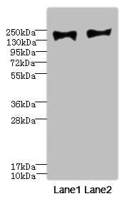 Polyclonal Rabbit anti-Human MRC2 / Endo180 Antibody (WB)