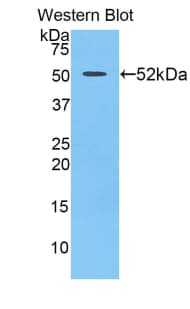 UPRT Antibody (aa75-297)