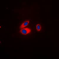 KCNJ3 / GIRK1 Antibody (phospho-Ser185)
