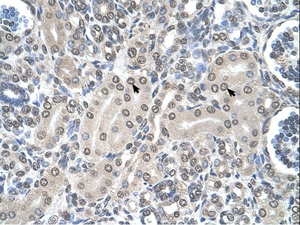 SHMT / SHMT2 Antibody (aa401-450)