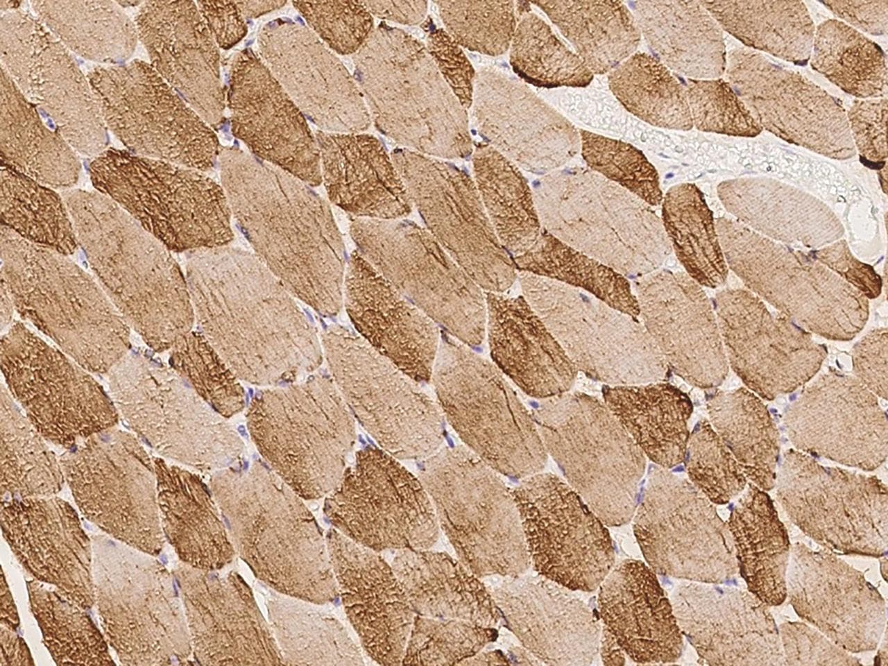 THTPA Antibody