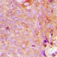 MRPS9 Antibody (Internal)