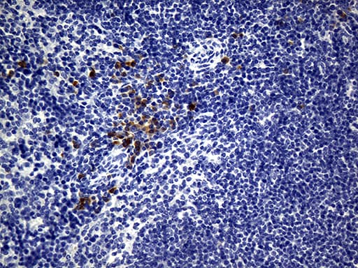 Monoclonal Mouse anti-Human CD74 / CLIP Antibody (clone UMAB232, IHC, WB)