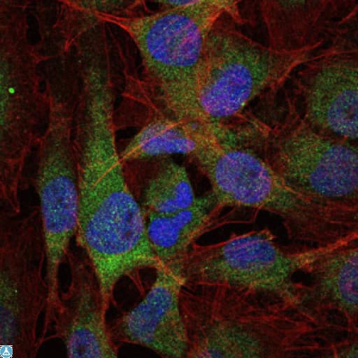 NFKB1 / NF-Kappa-B Antibody