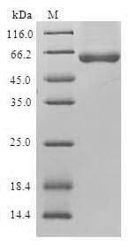 Human NAPG Protein (Recombinant GST, N-terminus)
