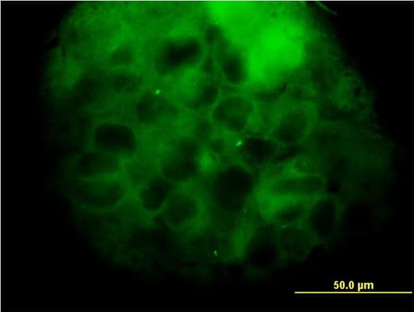 MVD Antibody (clone 2A7)