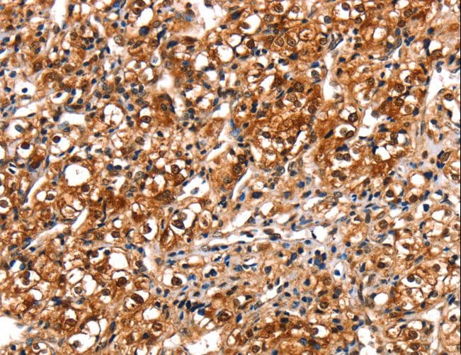 Polyclonal Rabbit anti-Human TRIM69 / Trif Antibody (IHC)
