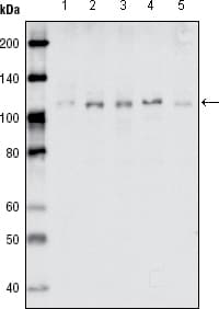 EPHB1 / EPH Receptor B1 Antibody (clone 5F10A4)