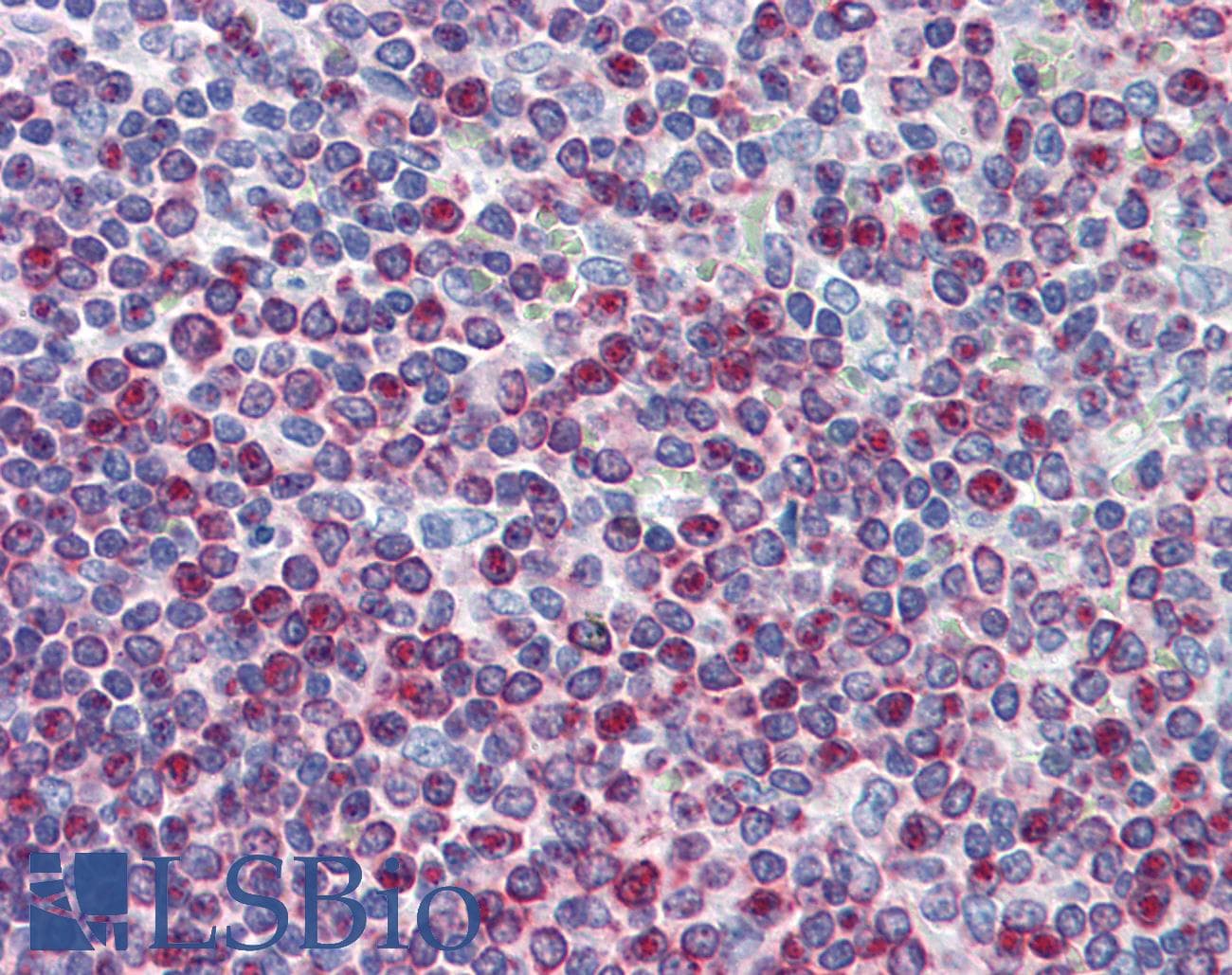 IHC-plus™ ATP2A3 / SERCA3 Antibody (clone 2H3)