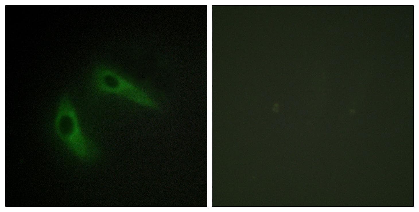 KCNIP1 / KCHIP1 Antibody