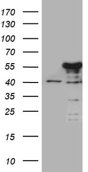 Monoclonal Mouse anti-Human NFKBIE / IKB Epsilon Antibody (clone OTI5D11, WB)