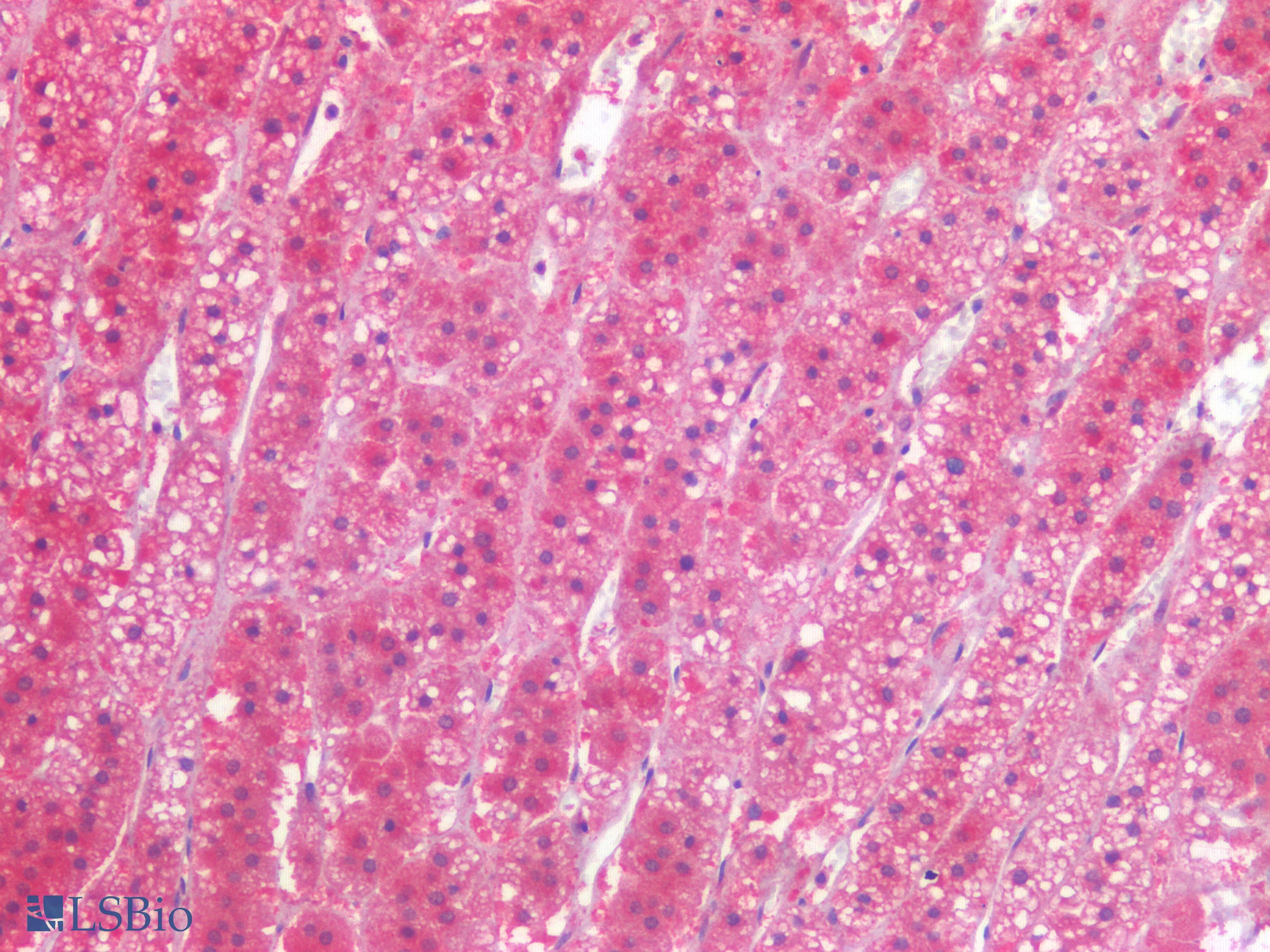 PathPlus™ Polyclonal Rabbit anti-Human TIAM1 Antibody (IHC)