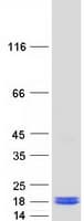 Human NGB / Neuroglobin Protein (Recombinant Myc-DDK (Flag))
