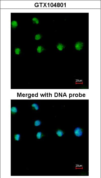 IHC-plus™ NR2F1 / Coup-TF Antibody (aa1-44)