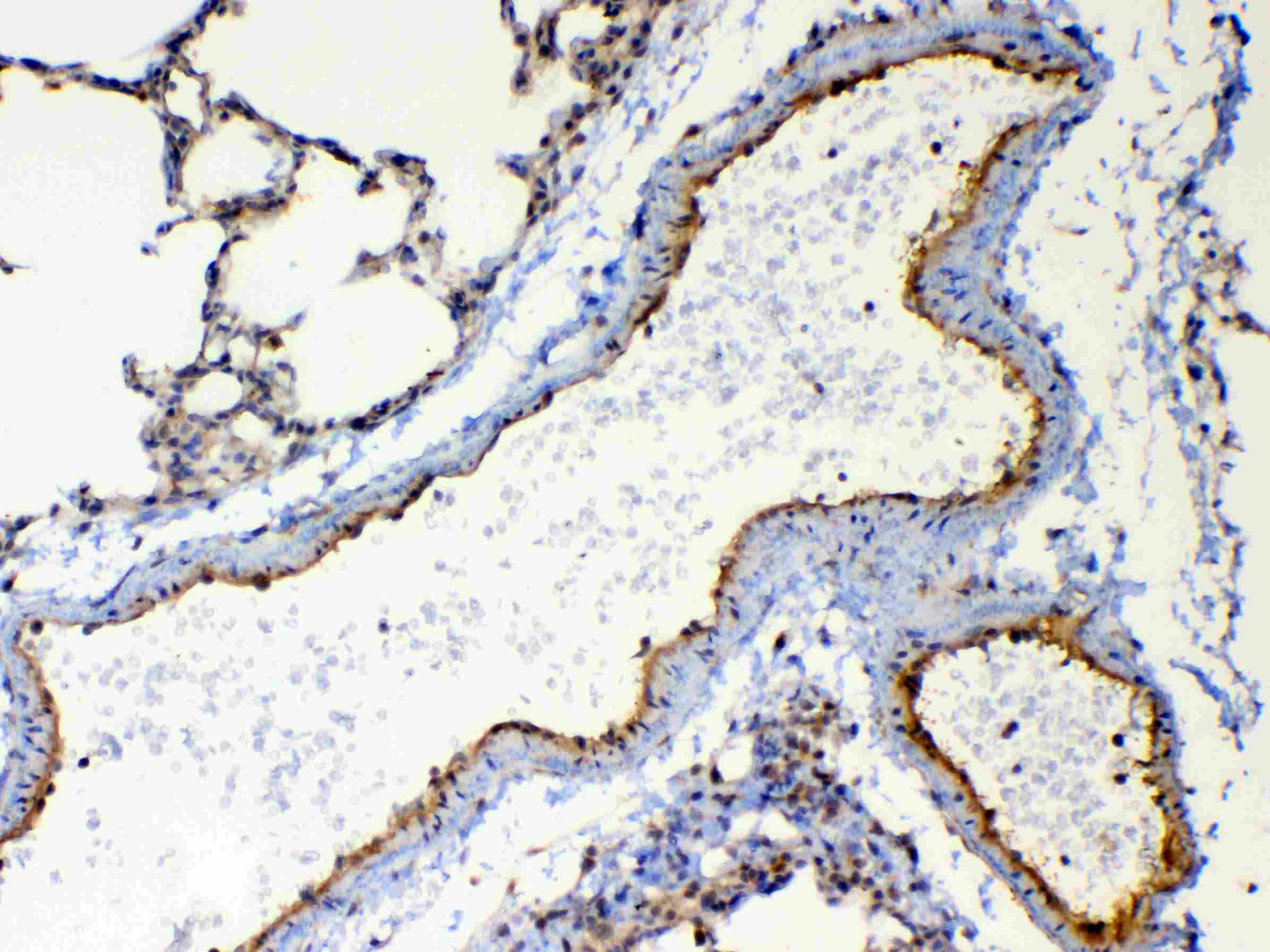 Polyclonal Rabbit anti-Human TSPAN12 Antibody (IHC, WB)