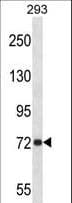 APP / Beta Amyloid Precursor Antibody (aa333-362)