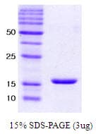 Human SNCA / Alpha-Synuclein Protein (Recombinant)