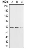 Polyclonal Rabbit anti-Human RIOK3 Antibody (Internal, WB)