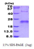 Human VEGFA / VEGF Protein (Recombinant His)