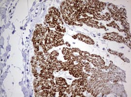 AFAP1 / AFAP Antibody (aa100-386, clone OTI2G9)