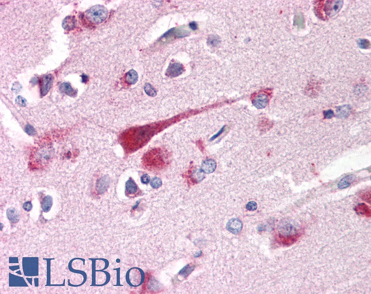 TMED10 / TMP21 Antibody (Internal, DY650)
