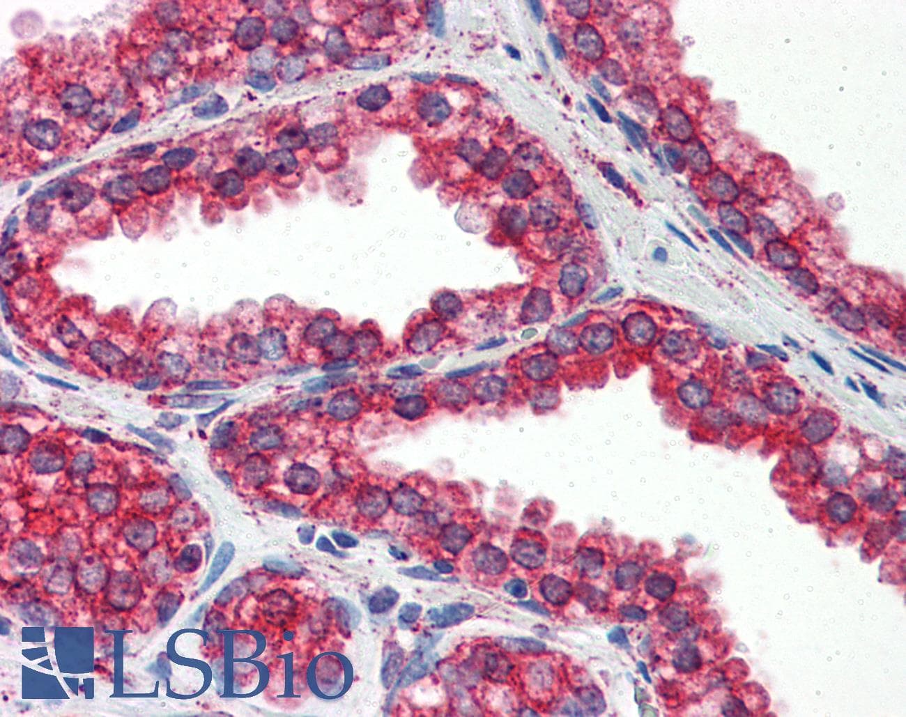 IHC-plus™ Monoclonal Mouse anti-Human HSP90B1 / GP96 / GRP94 Antibody (clone 2H3, aa676-803, IHC, IF, WB)