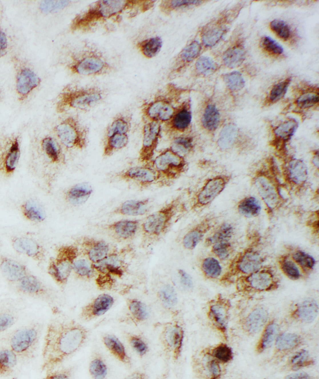 SMAD1 Antibody (aa253-267)