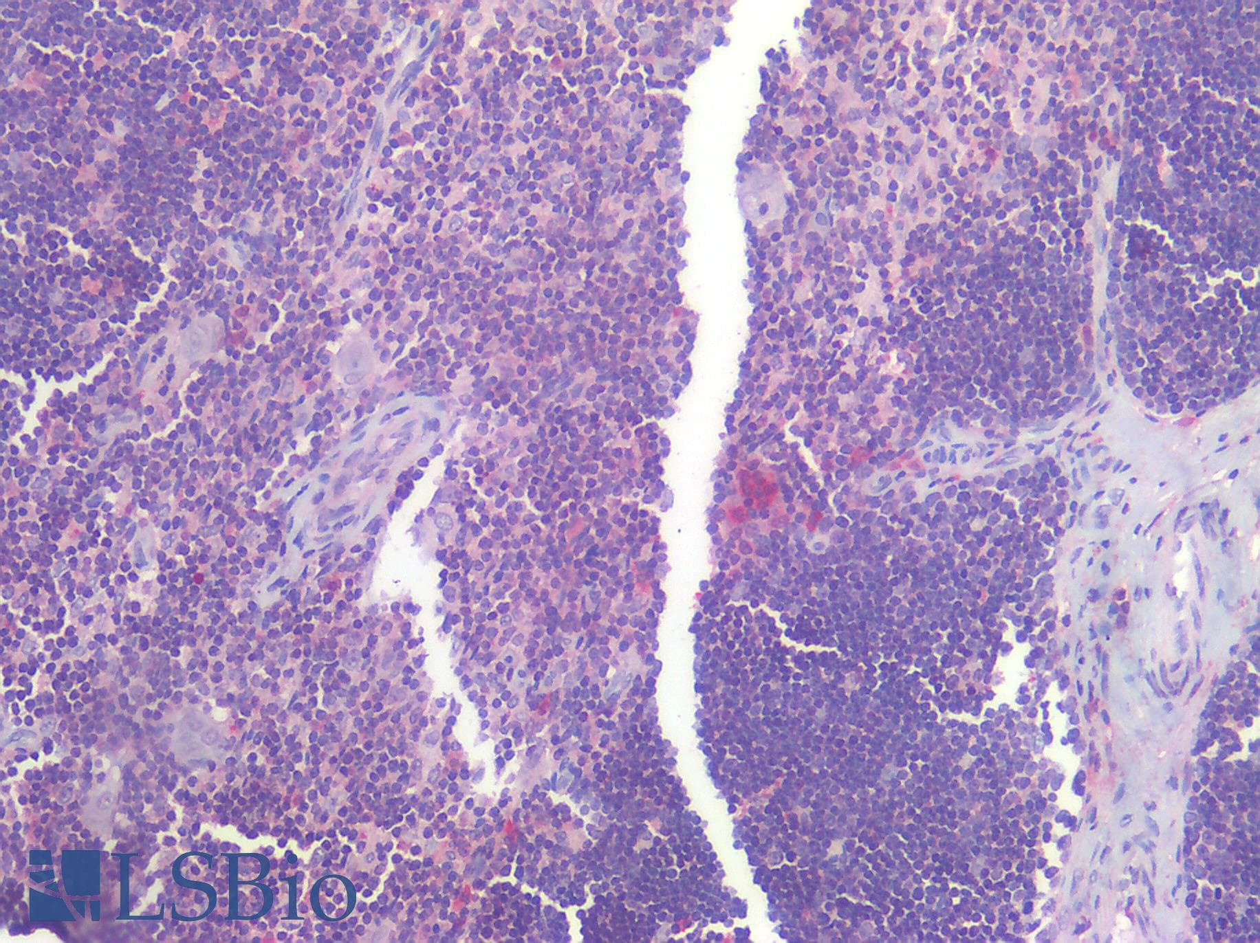 IHC-plus™ IL6R / IL6 Receptor Antibody