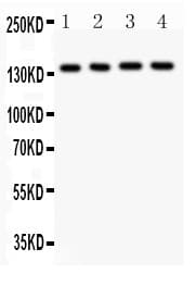 ABCB4 / MDR3 Antibody (aa601-720)