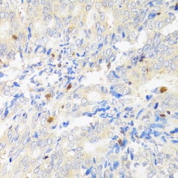 STAT4 Antibody