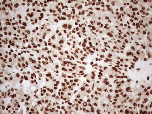 Monoclonal Mouse anti-Human ALOX5 / 5-LOX Antibody (clone OTI3F1, aa18-364, IHC, WB)