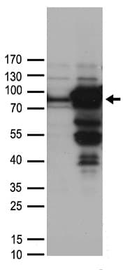 Polyclonal Rabbit anti-Human WDR48 Antibody (WB)