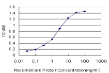 STK38 Antibody (clone 3A5)