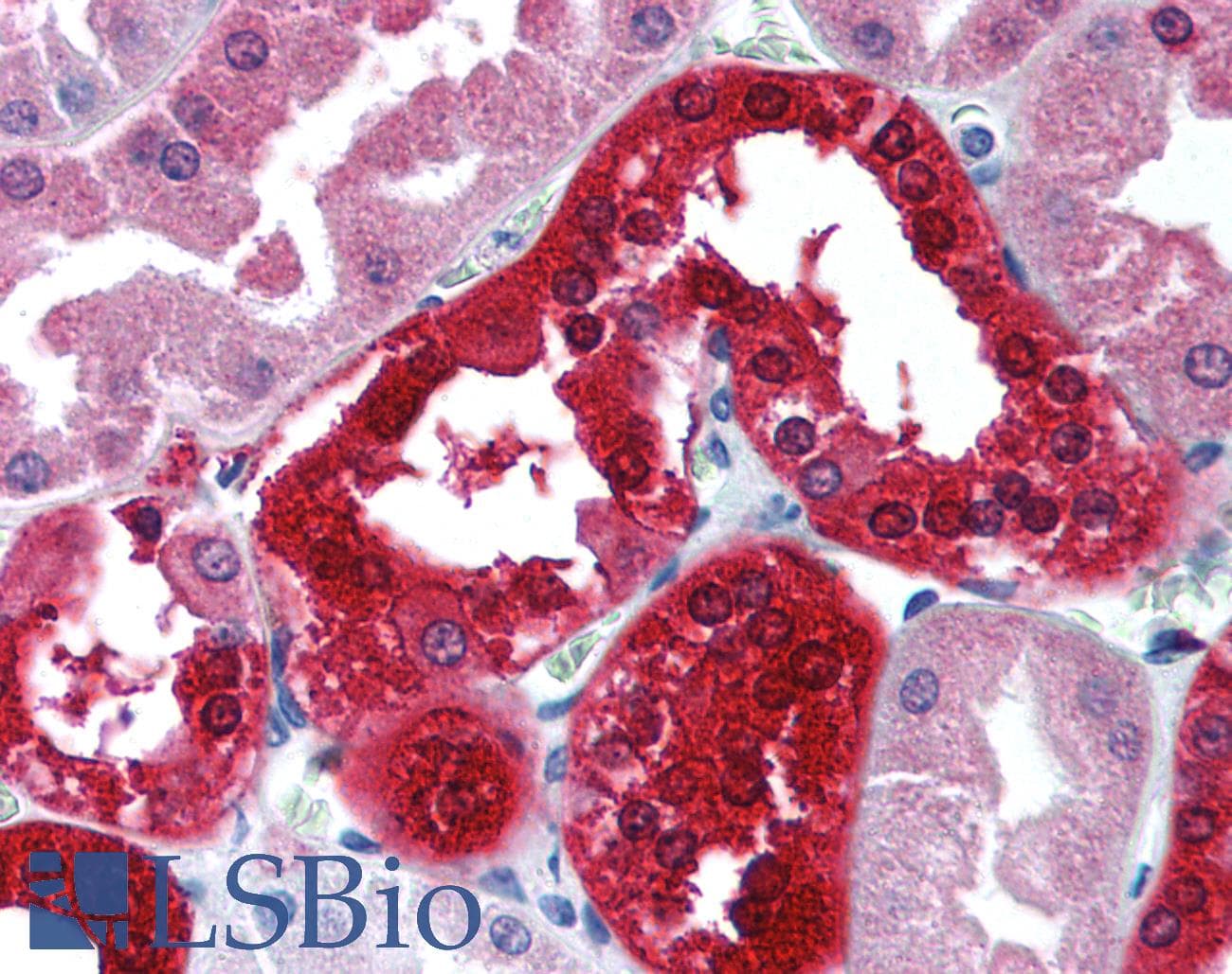 IHC-plus™ CA2 / Carbonic Anhydrase II Antibody (HRP)