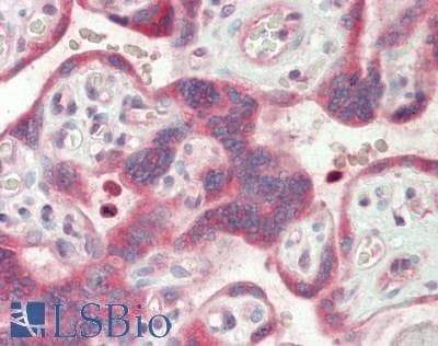IHC-plus™ RELA / NFKB p65 Antibody (aa402-451)