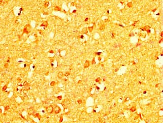 RAB26 Antibody