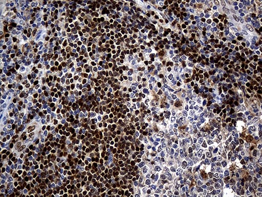 ALOX5 / 5-LOX Antibody (aa18-364, clone OTI1C1)