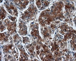 RIP1 / RALBP1 Antibody (clone OTI6E8)