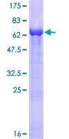 Human SERPINB2 / PAI-2 Protein (Recombinant GST)