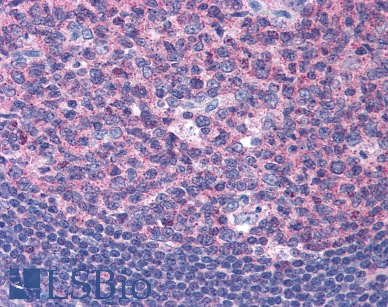 IHC-plus™ SNX16 Antibody (aa2-14)